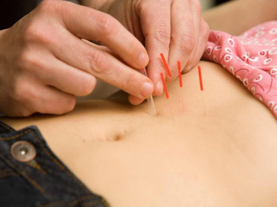 Akupunktur-für-Magen-und-Darm-Blogbeiträge-Haßdenteufel